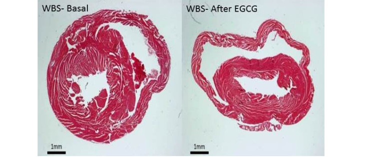 Un compuesto presente en el té verde podría mejorar las alteraciones del síndrome de Williams-Beuren