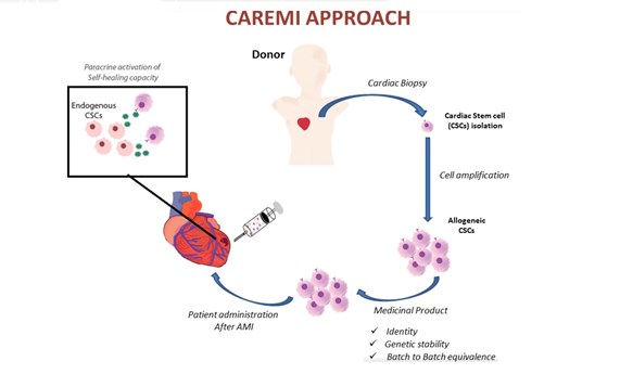 CAREMI concluye que las células madre donadas son una opción viable y segura tras un infarto