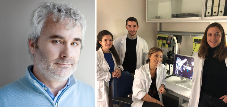 Las células gliales defectuosas se vinculan al Parkinson