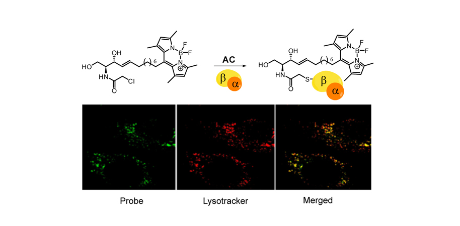 Desarrollan un nuevo método para el diagnóstico de la enfermedad de Farber