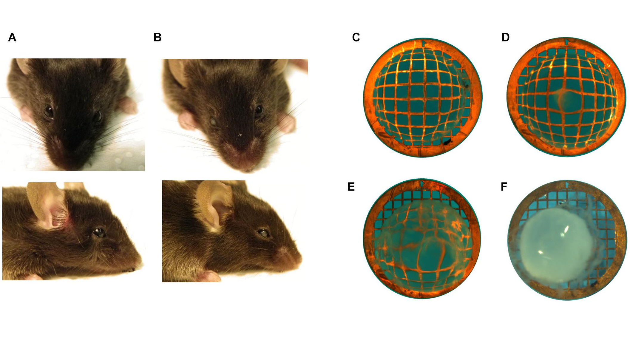 Identifican un transportador de aminoácidos como responsable de la aparición de cataratas congénitas