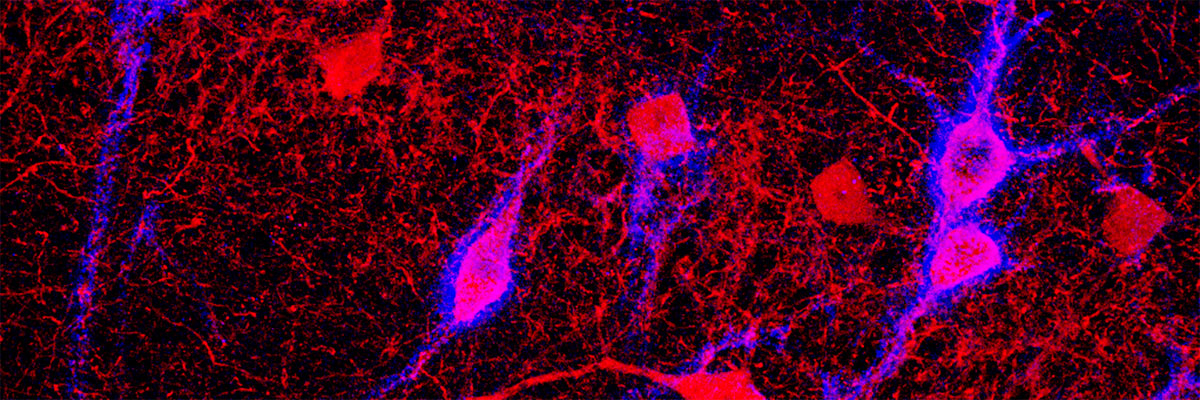 Una investigación proporciona nuevos datos acerca de las alteraciones del cerebro en las enfermedades psiquiátricas
