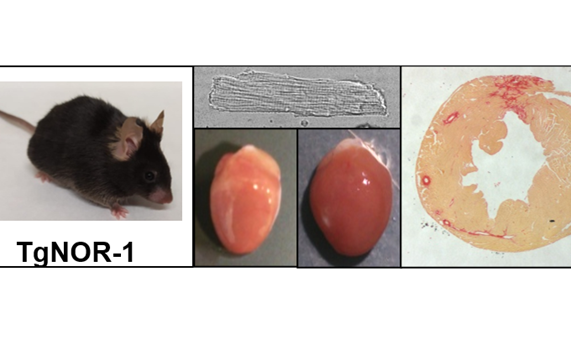 Un ratón transgénico evidencia el papel clave de una proteína en la hipertrofia cardíaca