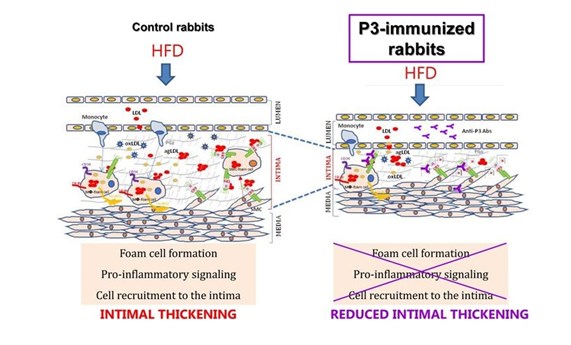 Una estrategia de inmunización con un péptido del dominio del receptor LRP1 logra reducir la aterosclerosis en conejos