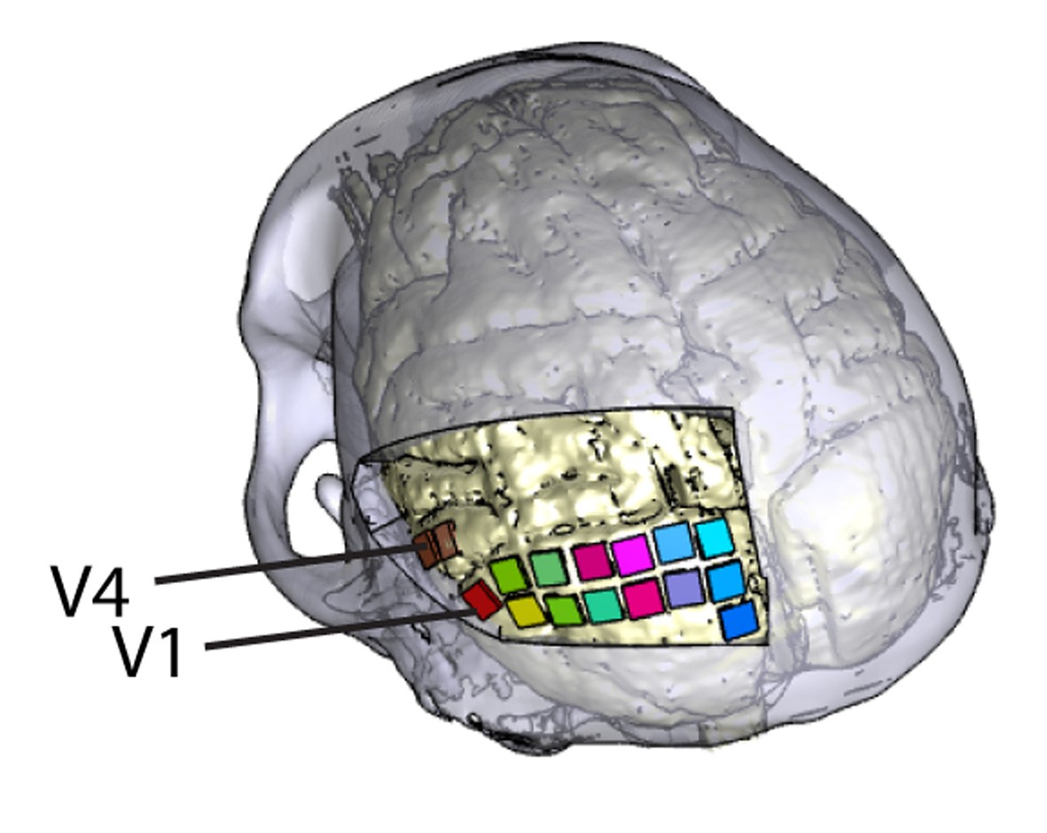 Desarrollado un nuevo implante cerebral con electrodos que podría ayudar a personas ciegas a percibir formas y letras
