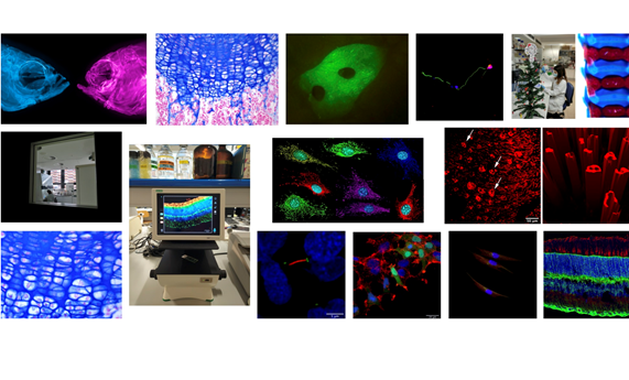 ‘Fish-to-Face’ y ‘Mitochondrial rainbow’, ganadoras del Concurso CIBERER de fotografía sobre investigación en enfermedades raras ‘Fish-to-Face’ y ‘Mitochondrial rainbow’, ganadoras del Concurso CIBERER de fotografía sobre investigación en enfermedades raras