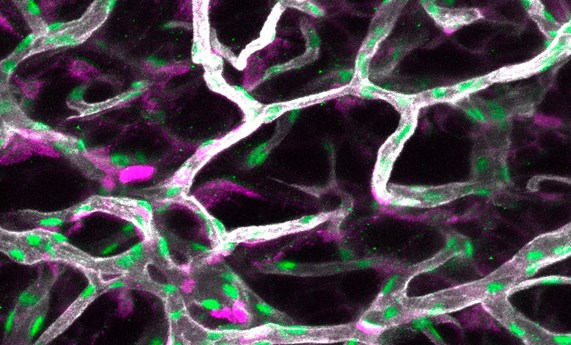 Identifican una comunicación molecular guiada por los vasos sanguíneos que regula la obesidad Identifican una comunicación molecular guiada por los vasos sanguíneos que regula la obesidad