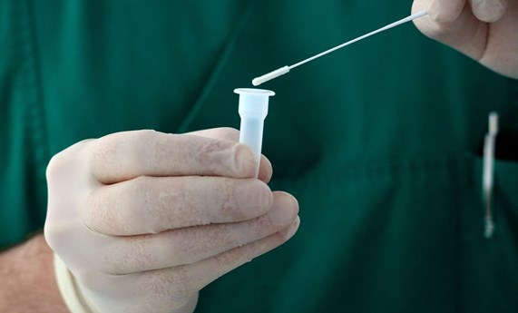 Los anticuerpos contra SARS-CoV2 se vuelven indetectables en más del 40% de los infectados transcurridos 7 meses de la infección Los anticuerpos contra SARS-CoV2 se vuelven indetectables en más del 40% de los infectados transcurridos 7 meses de la infección