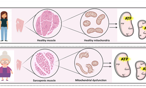 Día mundial de la actividad física: analizan la importancia del ejercicio de fuerza muscular para prevenir la fragilidad en las personas mayores y favorecer un envejecimiento saludable Día mundial de la actividad física: analizan la importancia del ejercicio de fuerza muscular para prevenir la fragilidad en las personas mayores y favorecer un envejecimiento saludable