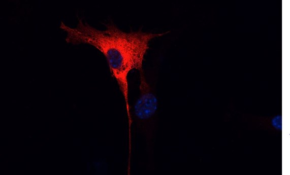 Descubierta una proteína que afecta a la eficacia de fármacos dirigidos al gen KRAS Descubierta una proteína que afecta a la eficacia de fármacos dirigidos al gen KRAS