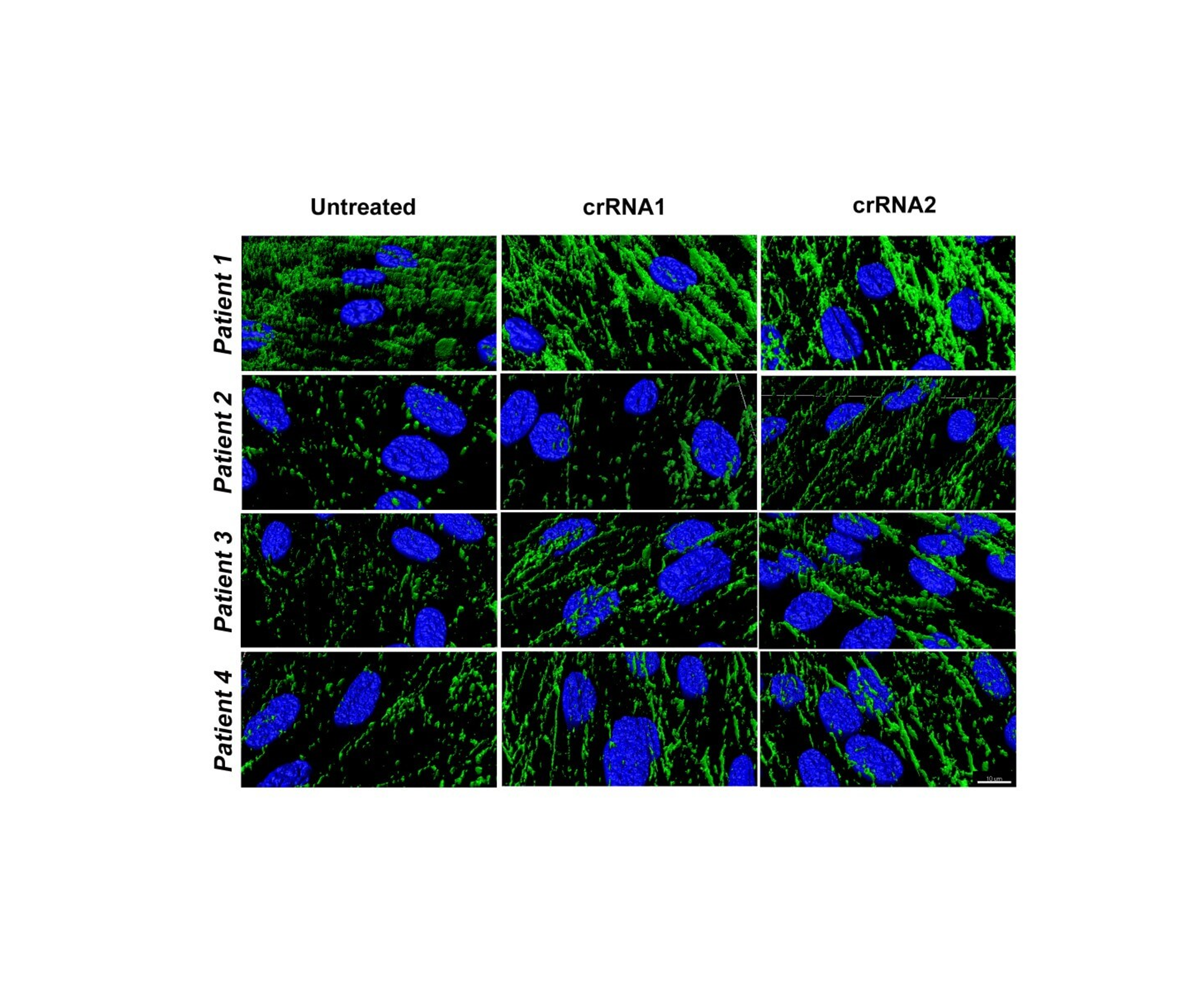 La edición genética por CRISPR/Cas9 abre las puertas a una nueva estrategia terapéutica para las distrofias musculares congénitas por déficit de colágeno VI
