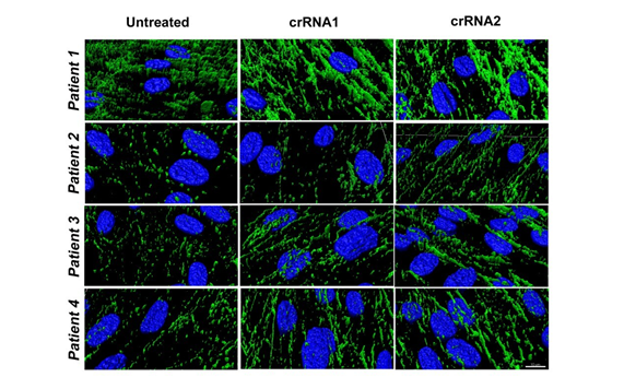La edición genética por CRISPR/Cas9 abre las puertas a una nueva estrategia terapéutica para las distrofias musculares congénitas por déficit de colágeno VI La edición genética por CRISPR/Cas9 abre las puertas a una nueva estrategia terapéutica para las distrofias musculares congénitas por déficit de colágeno VI
