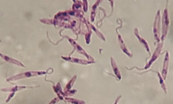 Una revisión sobre una familia de proteínas en los parásitos que causan la leishmaniasis podría facilitar la búsqueda de nuevos tratamientos Una revisión sobre una familia de proteínas en los parásitos que causan la leishmaniasis podría facilitar la búsqueda de nuevos tratamientos