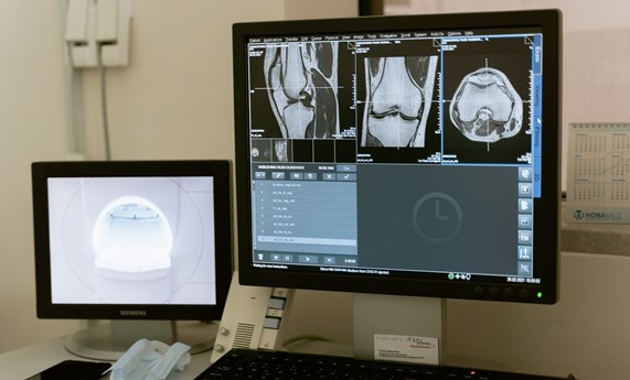 Desarrollan un nanovehículo portador de antibiótico y cobre para el tratamiento de infecciones óseas Desarrollan un nanovehículo portador de antibiótico y cobre para el tratamiento de infecciones óseas