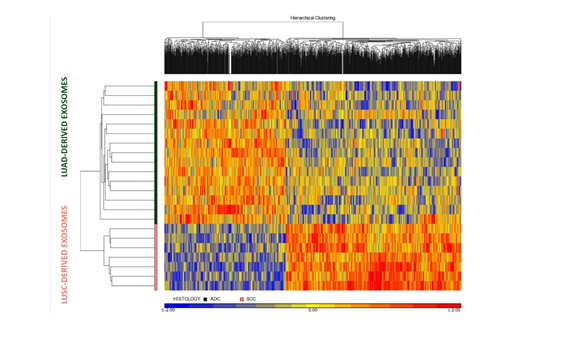 Buscan nuevos biomarcadores en vesículas extracelulares en cáncer de pulmón Buscan nuevos biomarcadores en vesículas extracelulares en cáncer de pulmón