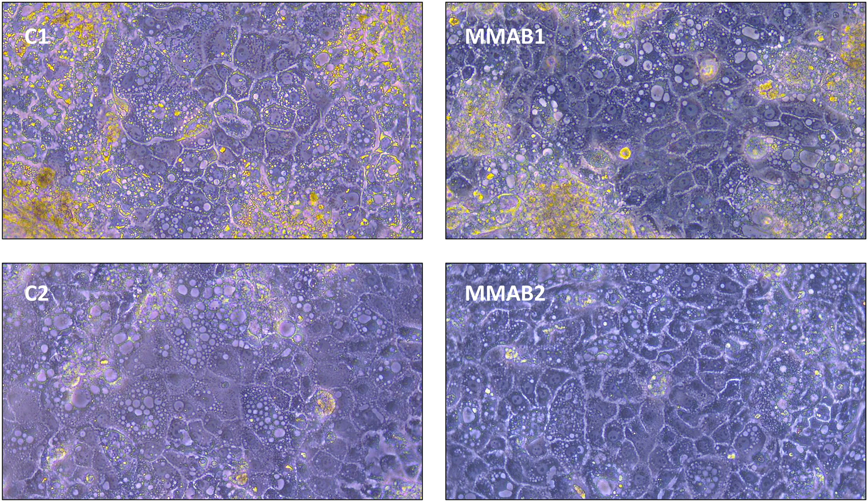 Diseñan una plataforma que evalúa farmacochaperonas en modelos celulares de acidemia metilmalónica tipo ‘cblB’