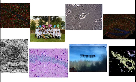 Abierta la votación del público del 3º Concurso CIBERER de fotografía sobre investigación en enfermedades raras Abierta la votación del público del 3º Concurso CIBERER de fotografía sobre investigación en enfermedades raras