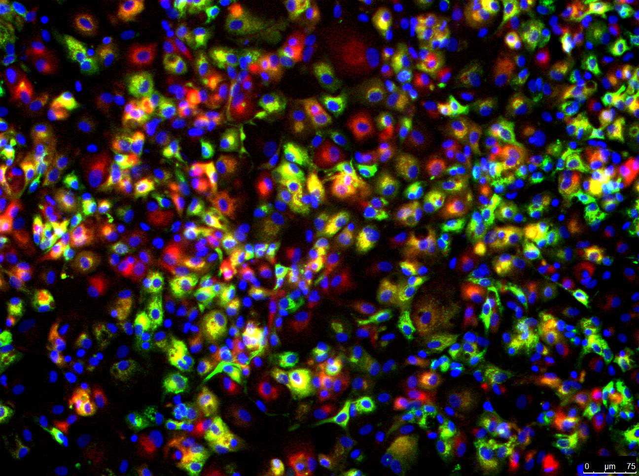 Estrategia pionera y mínimamente invasiva para la generación de hepatocitos de pacientes individuales para estudios farmacotoxicológicos hepáticos