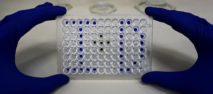Ocho nuevos proyectos ACCI refuerzan la investigación colaborativa del CIBERER con el impulso de los pacientes