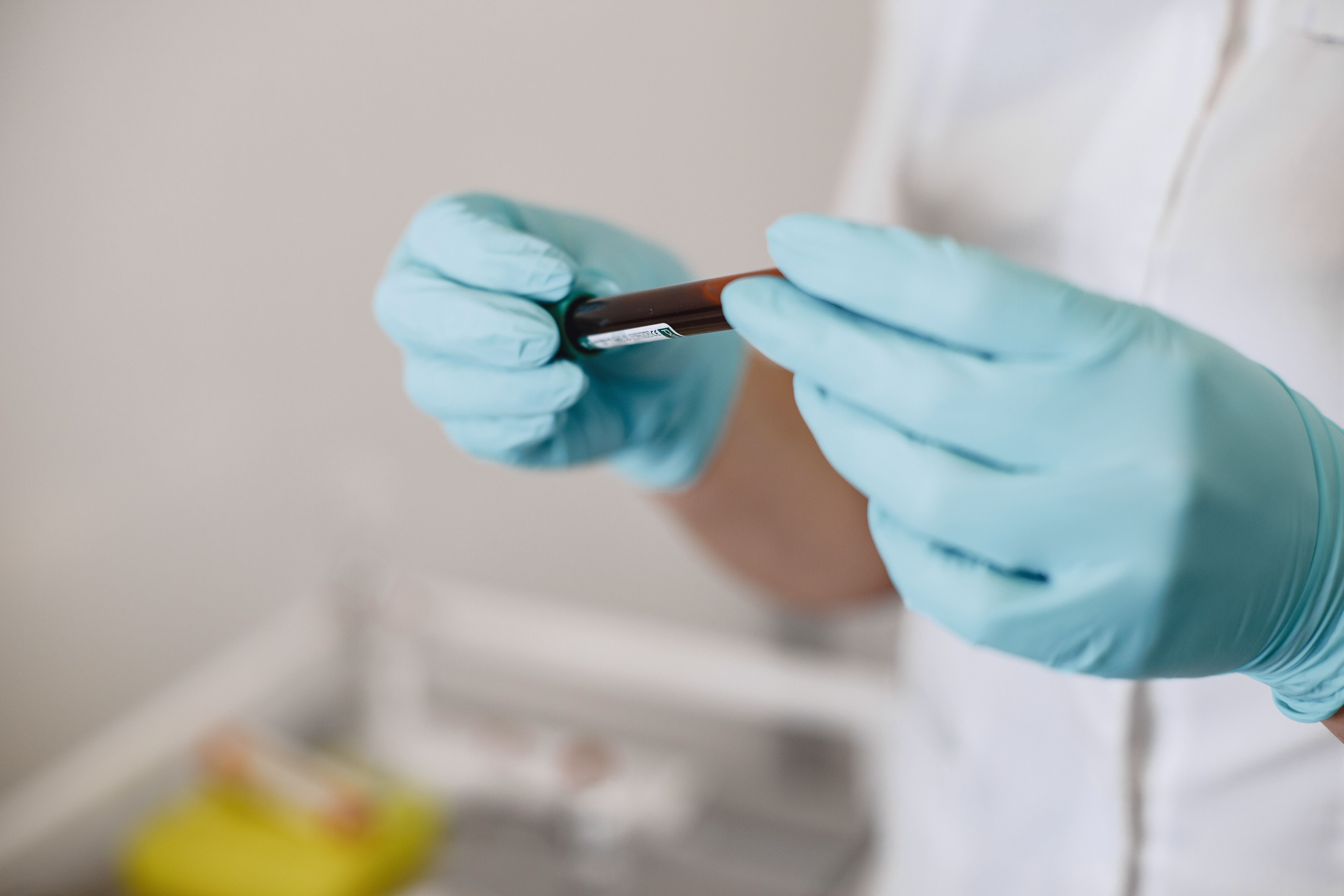 Un estudio halla biomarcadores en sangre que podrían medir la respuesta a las psicoterapias en pacientes con depresión