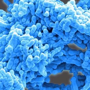 Nuevas vacunas contra la tuberculosis