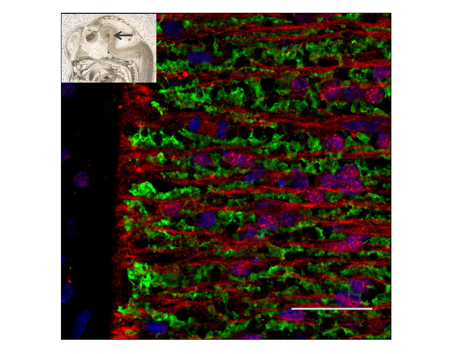 La vulnerabilidad a padecer adicciones podría gestarse en los primeros momentos del desarrollo del cerebro